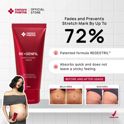 Filmore Regenfil Stretch Mark Cream with REGESTRIL™