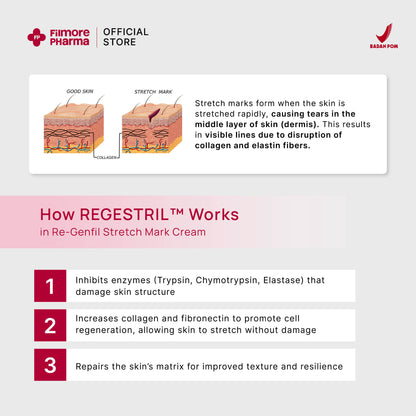 Filmore Regenfil Stretch Mark Cream with REGESTRIL™