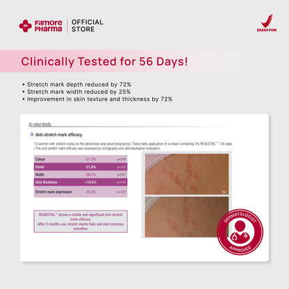 Filmore Regenfil Stretch Mark Cream with REGESTRIL™
