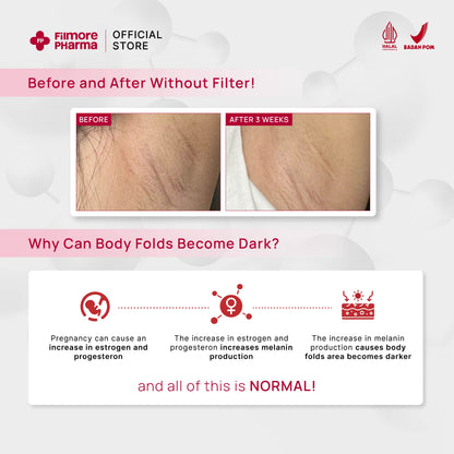 Filmore Inner Thigh Brightening Cream