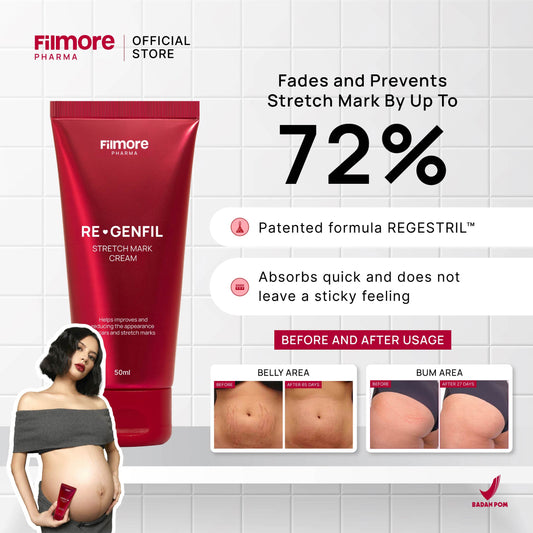 Filmore Regenfil Stretch Mark Cream with REGESTRIL™