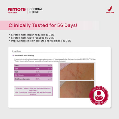 Filmore Regenfil Stretch Mark Cream with REGESTRIL™